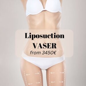 liposuction vaser medical tourism